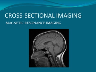 CROSS-SECTIONAL IMAGING
MAGNETIC RESONANCE IMAGING
 