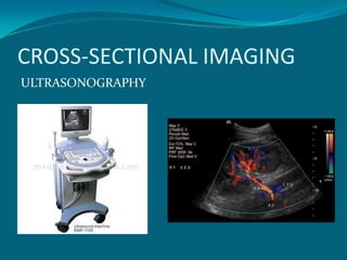 CROSS-SECTIONAL IMAGING
ULTRASONOGRAPHY
 