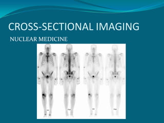 CROSS-SECTIONAL IMAGING
NUCLEAR MEDICINE
 