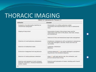 THORACIC IMAGING
 