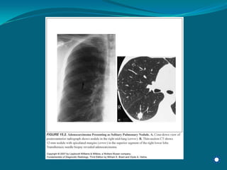 Radiology Np Students2