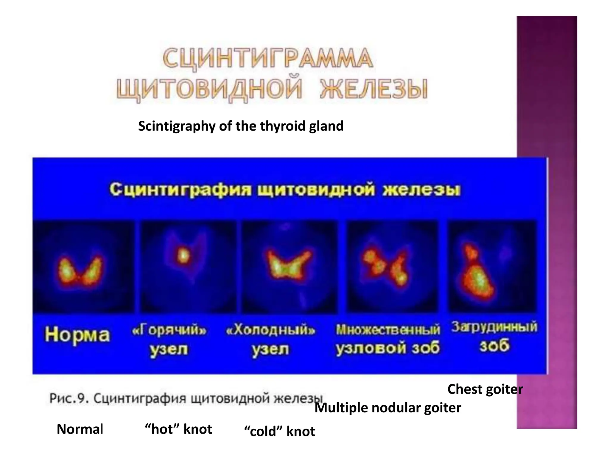 Radiology od Endocrine system Lecture.pptx