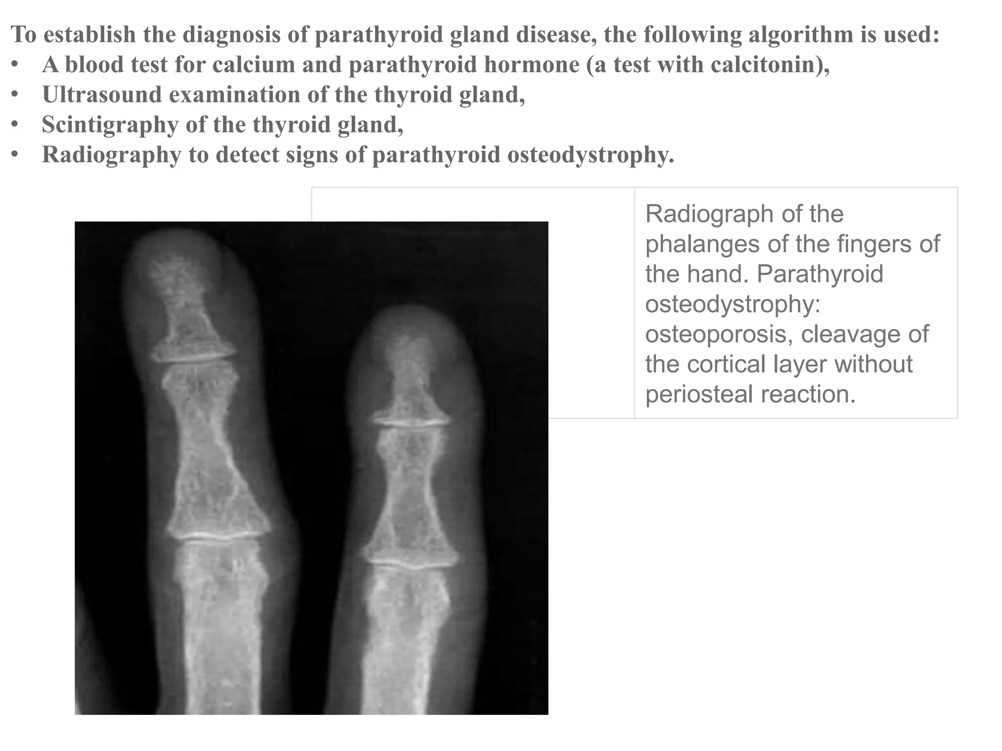 Radiology od Endocrine system Lecture.pptx