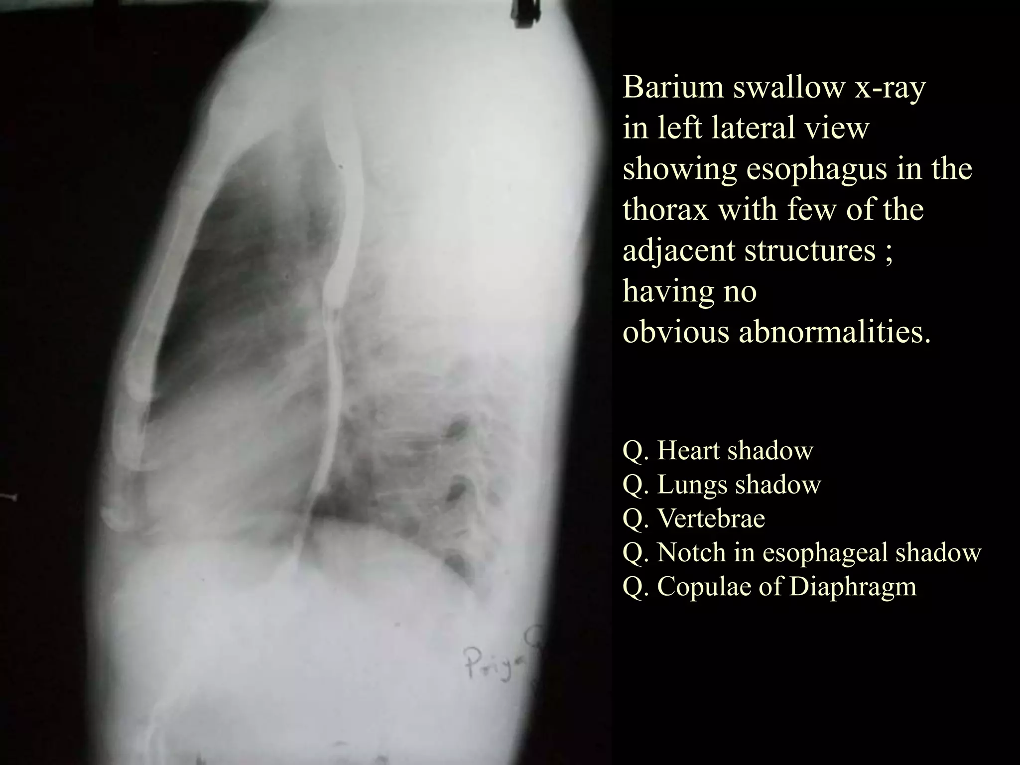 Radiology of abdomen | PPT