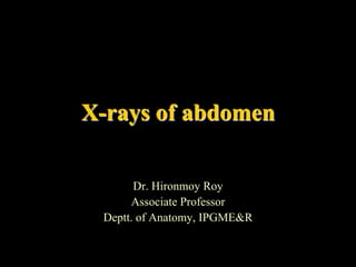 X-rays of abdomen
Dr. Hironmoy Roy
Associate Professor
Deptt. of Anatomy, IPGME&R
 