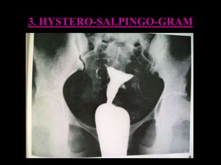 Radiology of abdomen | PPT