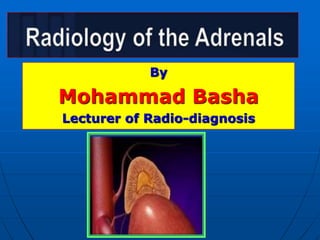 Radiology of adrenals | PPTX