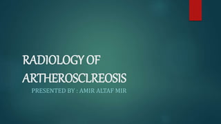 RADIOLOGY OF
ARTHEROSCLREOSIS
PRESENTED BY : AMIR ALTAF MIR
 