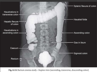 Eed Normal Edwards- Radiology for students | PPTX