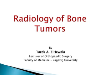 By
Tarek A. ElHewala
Lecturer of Orthopaedic Surgery
Faculty of Medicine – Zagazig University
 