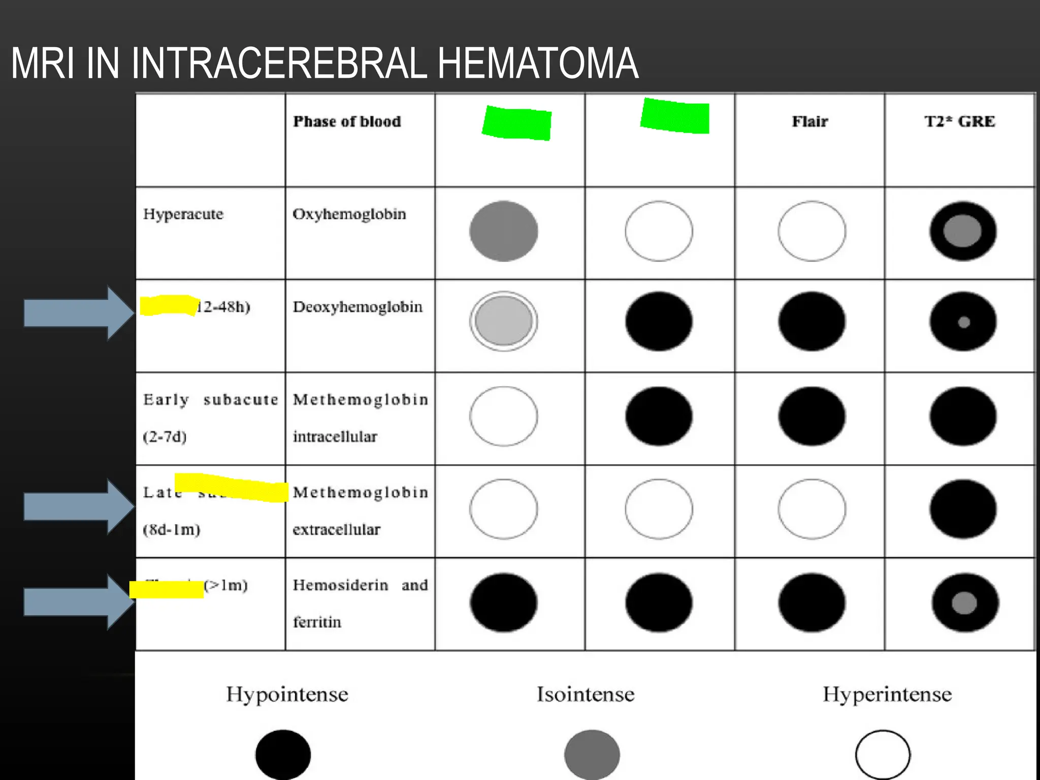 Radiological anatomy of Brain and stroke imaging.ppt