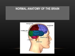 Radiological anatomy of Brain and stroke imaging.ppt