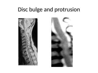 Radiology Of Central Nervous System.pptx