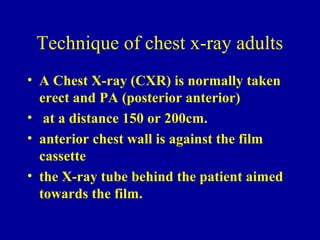 Distance Chest Radiology of chest 1st year2 | PPT