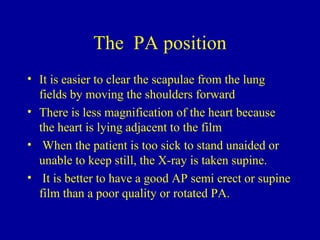 Radiology of chest 1st year2 | PPT