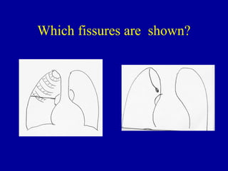 Radiology of chest 1st year2 | PPT