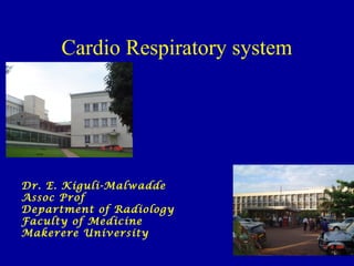 Cardio Respiratory system
Dr. E. Kiguli-Malwadde
Assoc Prof
Department of Radiology
Faculty of Medicine
Makerere University
 