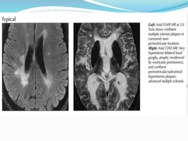 Xray iso penisAussie kypsä porno