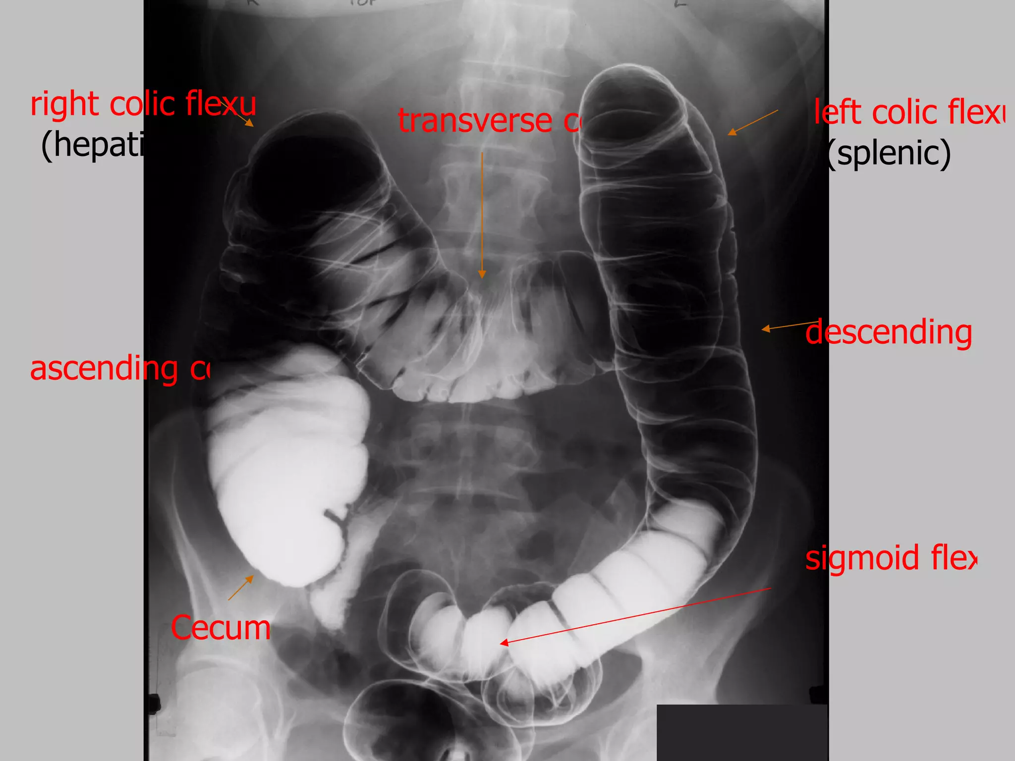 Radiology of digestive system | PPT