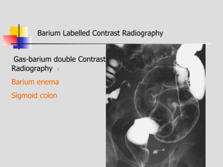 Bari Injection Radiology of digestive system | PPT