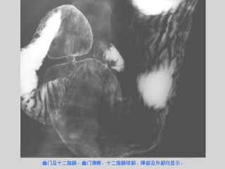 Radiology of digestive system | PPT