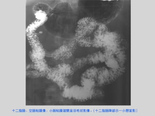Radiology of digestive system | PPT
