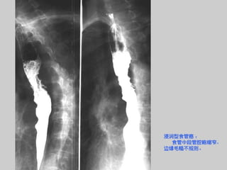 Radiology of digestive system | PPT