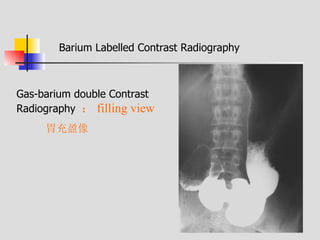 Bari Injection Radiology of digestive system | PPT