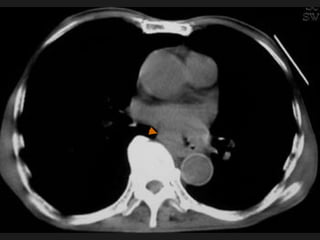 Radiology of digestive system | PPT