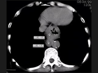 Radiology of digestive system | PPT