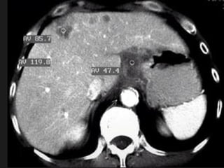 Radiology of digestive system | PPT