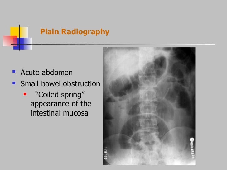 Radiology of digestive system