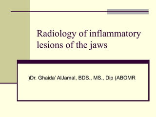 Radiology of inflammatory
lesions of the jaws
Dr. Ghaida’ AlJamal, BDS., MS., Dip (ABOMR(
 