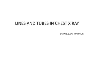 LINES AND TUBES IN CHEST X RAY
Dr.T.V.S.S.SAI MADHURI
 