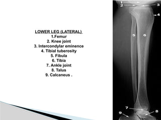RADIOLOGY OF LOWER LIMB - Anatomy .pptx