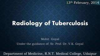 13th February, 2014

Radiology of Tuberculosis
Mohit Goyal
Under the guidance of: Sr. Prof. Dr. V.K. Goyal

Department of Medicine, R.N.T. Medical College, Udaipur

 