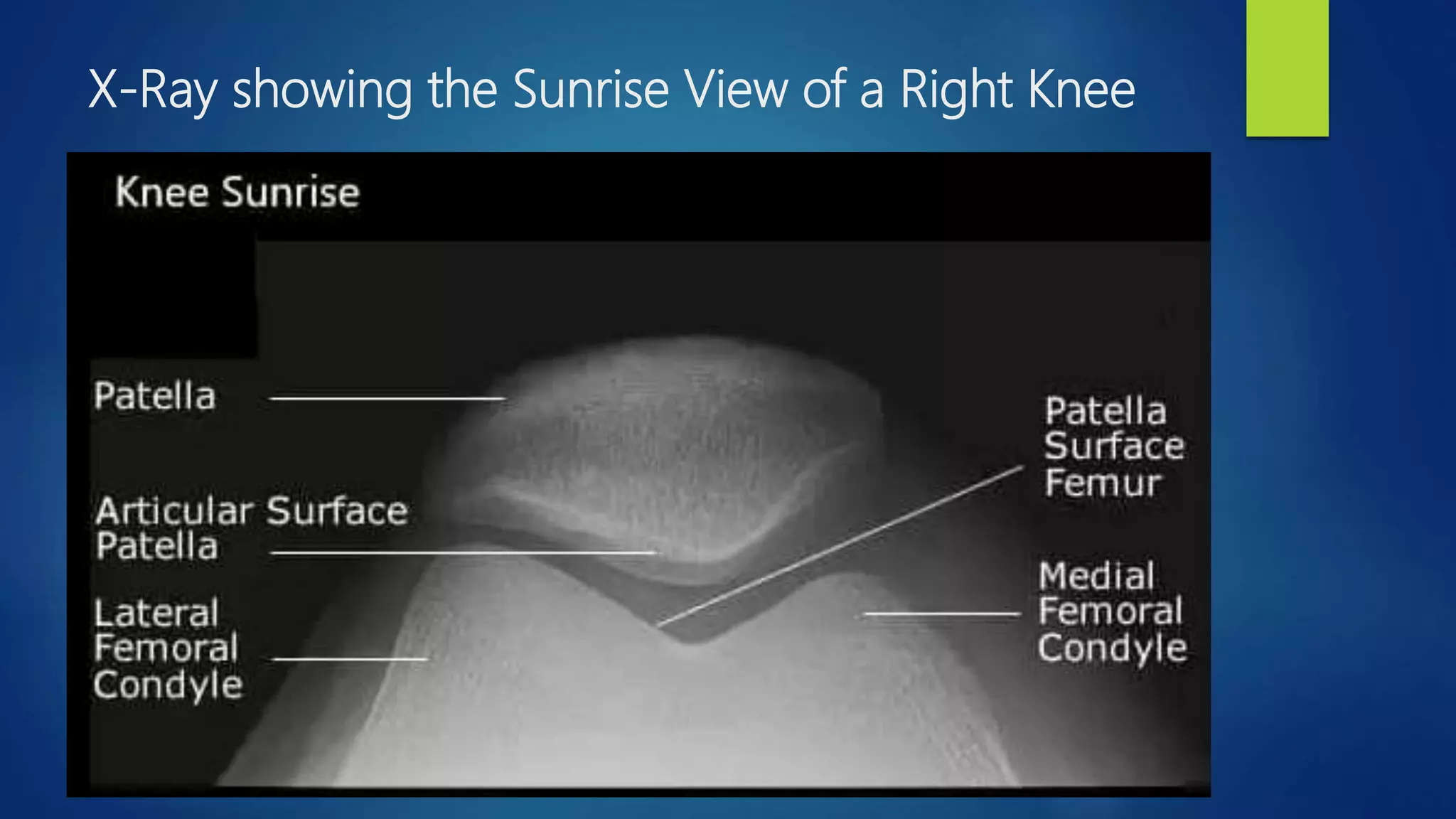 Radiology of the lower extremity dr asif ali khan | PPTX