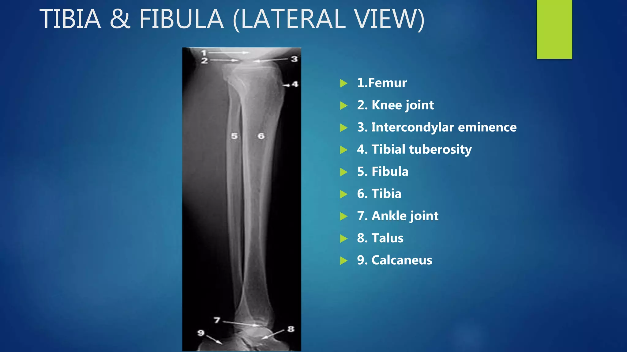 Radiology of the lower extremity dr asif ali khan | PPTX