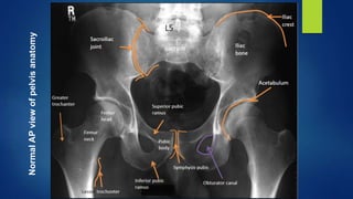 Radiology of the lower extremity dr asif ali khan | PPTX