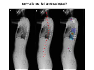 Radiology_of_the_Normal_Spine_with_Labeled_Images 083448 am_ba7915 ...