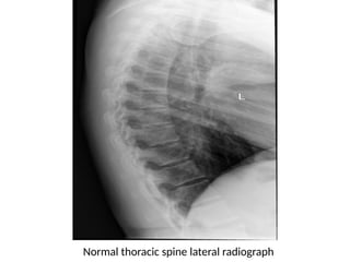 Radiology_of_the_Normal_Spine_with_Labeled_Images 083448 am_ba7915 ...