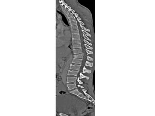Radiology_of_the_Normal_Spine_with_Labeled_Images 083448 am_ba7915 ...