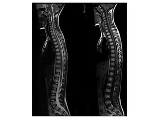 Radiology_of_the_Normal_Spine_with_Labeled_Images 083448 am_ba7915 ...