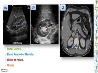Renal Rotation Radiology Radiology of the renal system.pptx