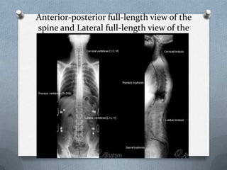 Spine Development Radiology Radiology of the spine and musc final 2012 | PPTX