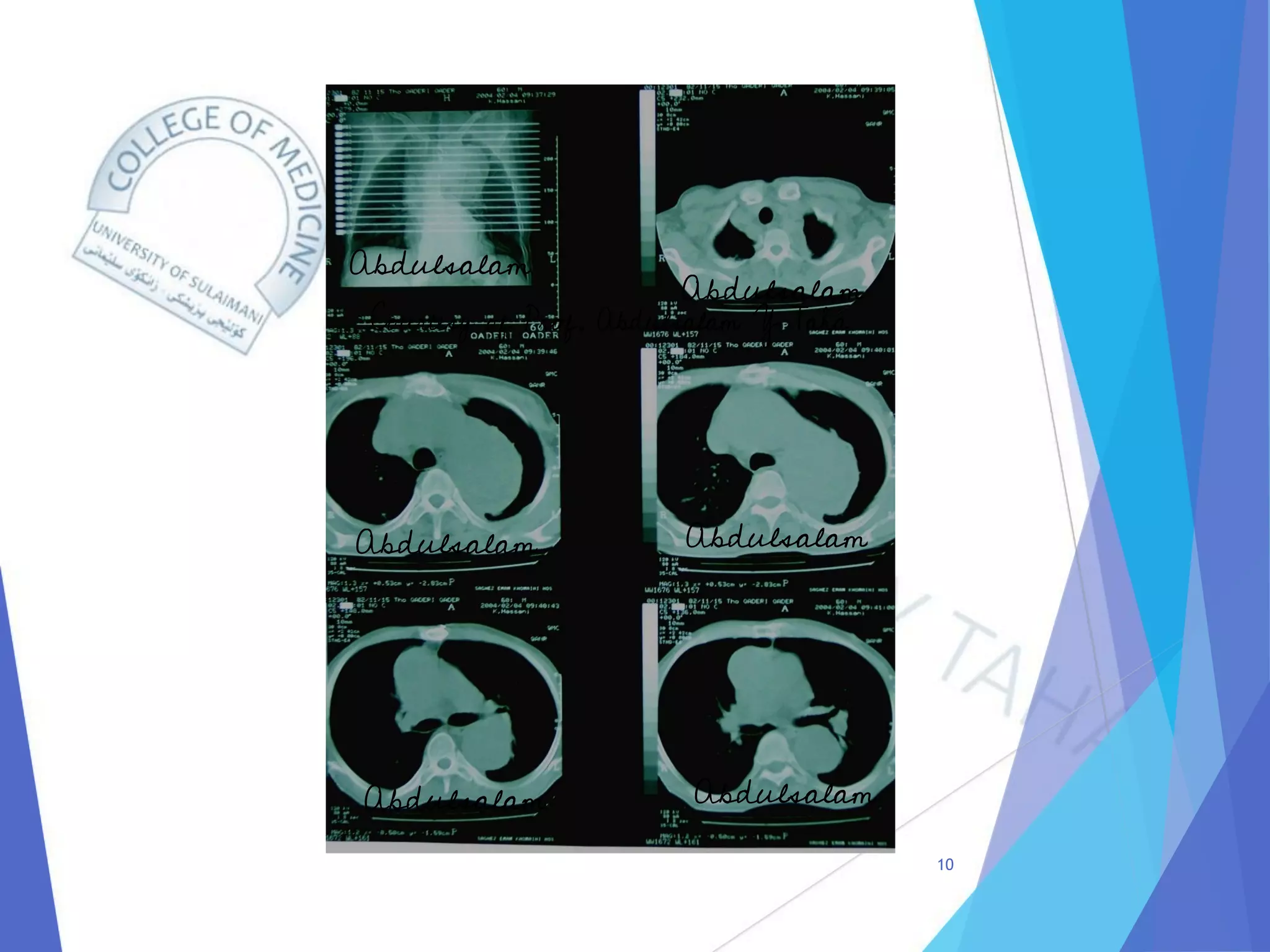 Radiology of Thoracic Aortic Aneurysms.pdf