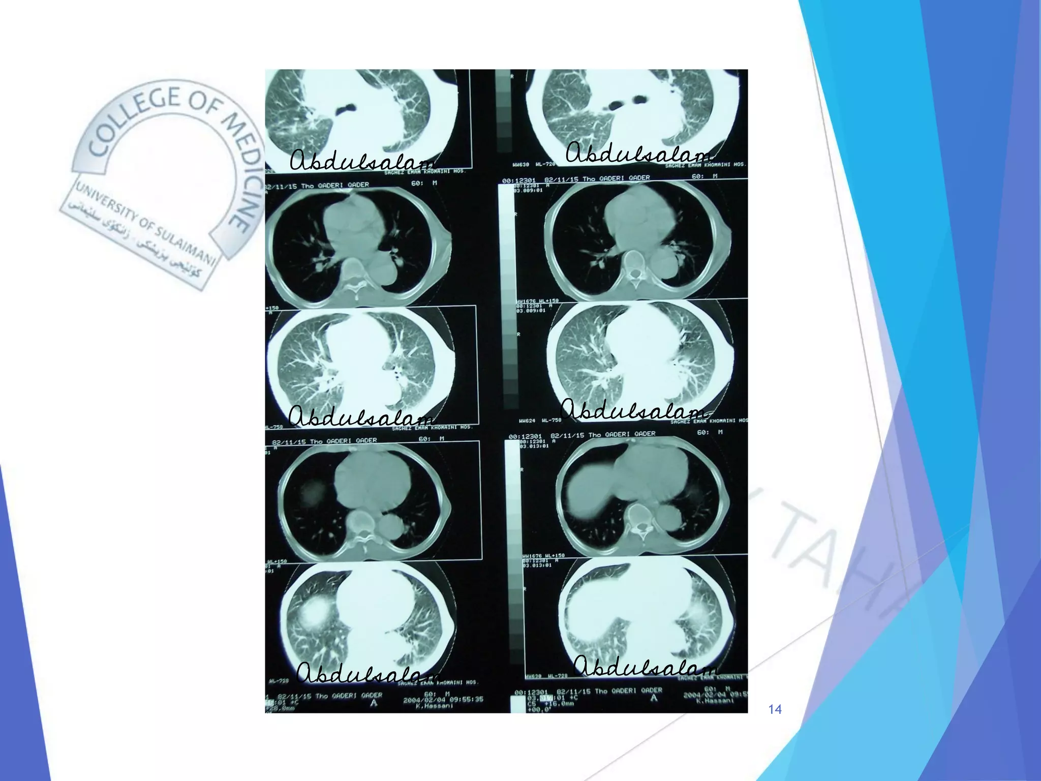 Radiology of Thoracic Aortic Aneurysms.pdf