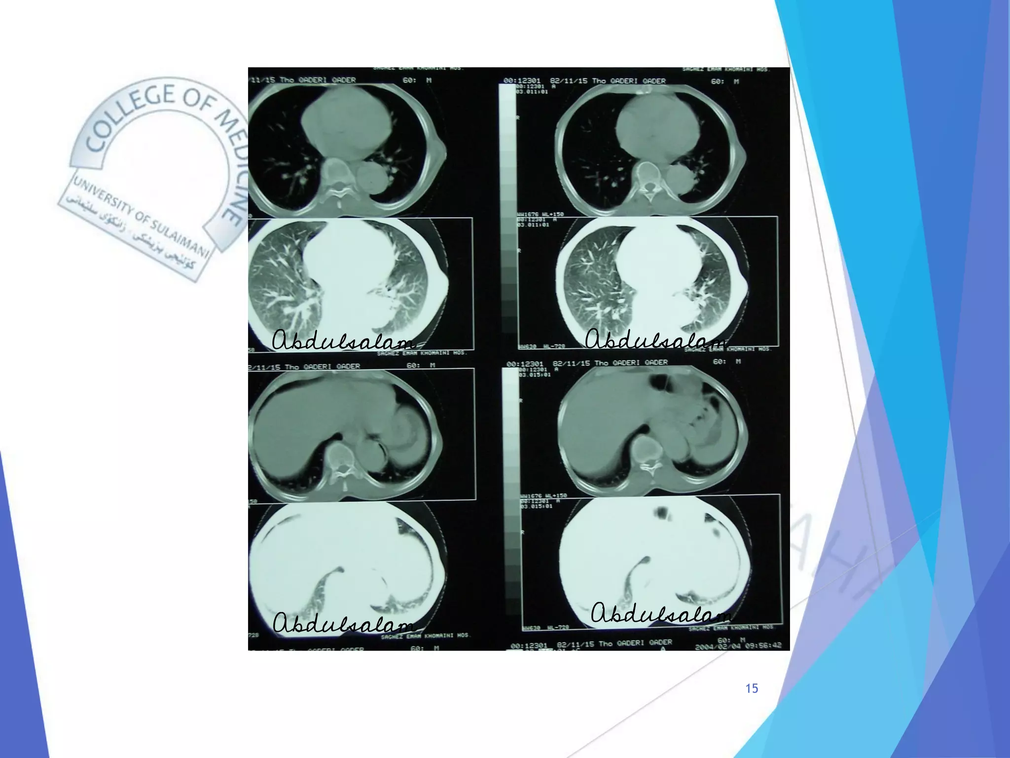 Radiology of Thoracic Aortic Aneurysms.pdf