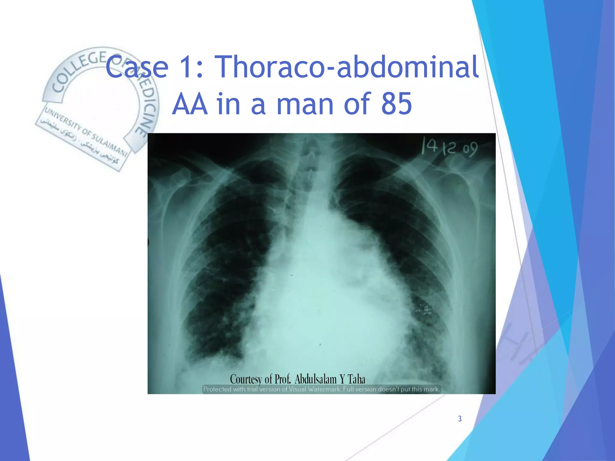 Radiology of Thoracic Aortic Aneurysms.pdf