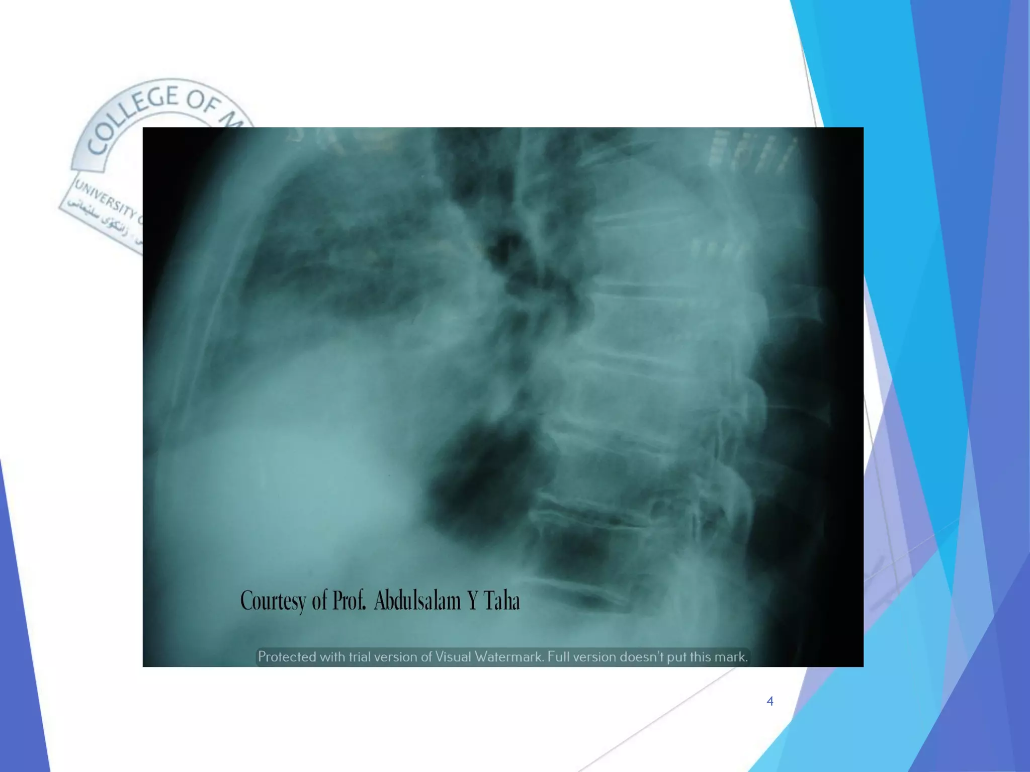 Radiology of Thoracic Aortic Aneurysms.pdf